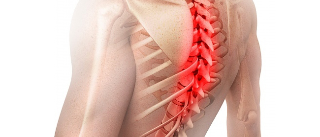 spinal diseases